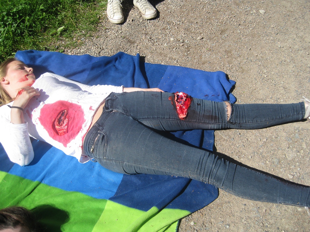 Førstehjelpskurs skadet ben